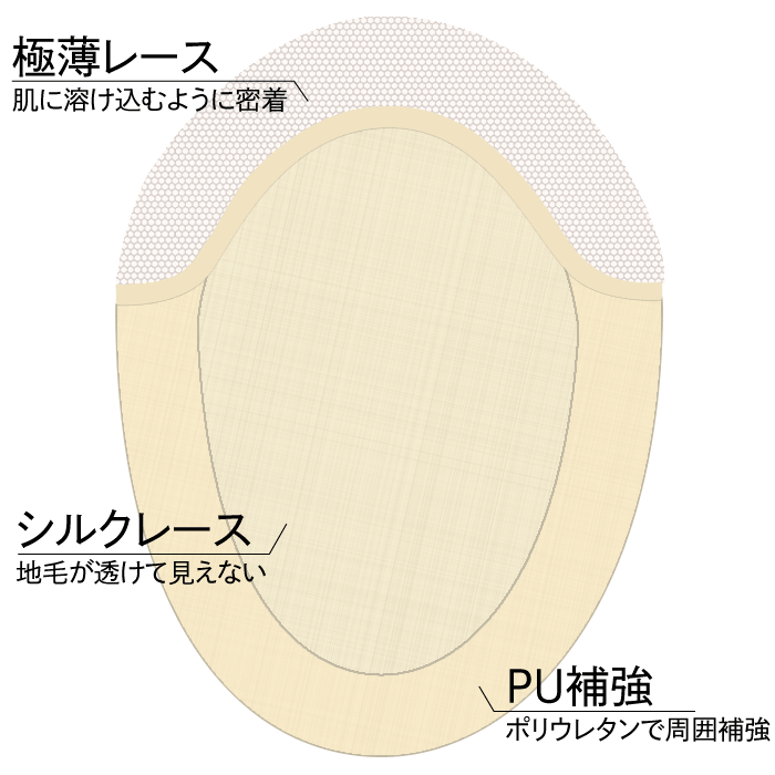 ベース説明模式図