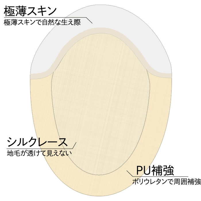 ベース説明模式図