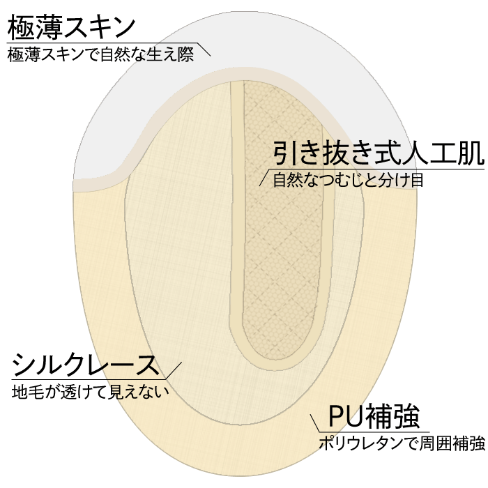 ベース説明模式図